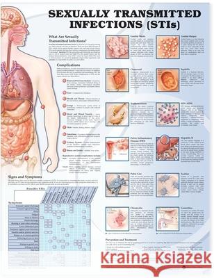 Sexually Transmitted Infections Anatomical Chart  Anatomical Chart Company 9781587798498 0