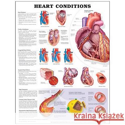 Heart Conditions  9781587798825 ANATOMICAL CHART CO ,U.S.