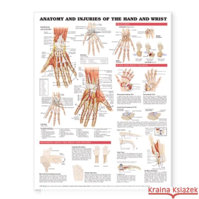 Anatomy and Injuries of the Hand and Wrist Anatomical Chart  Anatomical Chart Company 9781587799136 0