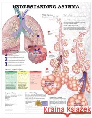 Understanding Asthma Anatomical Chart  9781587799372 ANATOMICAL CHART CO ,U.S.