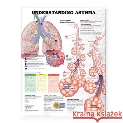 Understanding Asthma Anatomical Chart  Anatomical Chart Company 9781587799389 0