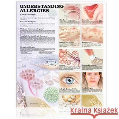 UNDERSTANDING ALLERGIES ANATOMICAL CHART  9781587799419 ANATOMICAL CHART CO ,U.S.