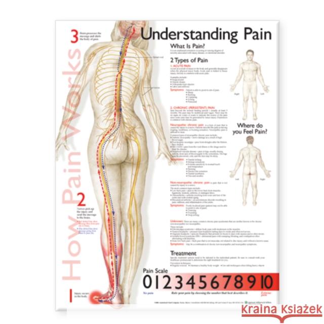 Understanding Pain Anatomical Chart  Anatomical Chart Company 9781587799846 0