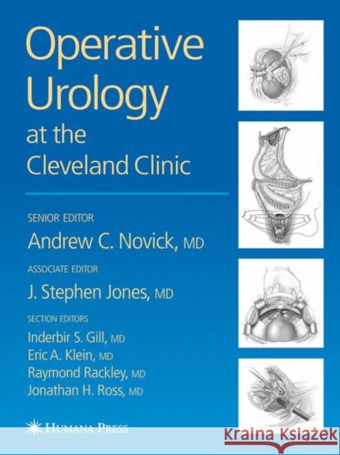 Operative Urology Andrew C. Novick J. Stephen Jones Inderbir S. Gill 9781588290816 Humana Press