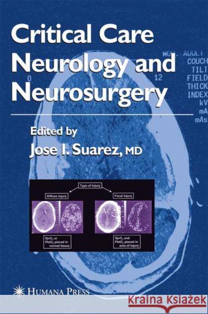 Critical Care Neurology and Neurosurgery Jose I. Suarez 9781588290892 Humana Press