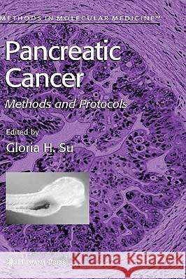 Pancreatic Cancer: Methods and Protocols Su, Gloria H. 9781588291073 Humana Press