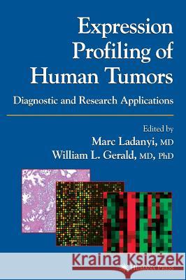 Expression Profiling of Human Tumors: Diagnostic and Research Applications Ladanyi, Marc 9781588291226 AACC Press