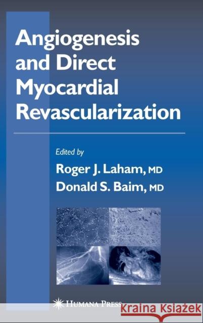 Angiogenesis and Direct Myocardial Revascularization Roger J. Laham Roger J. Laham Donald S. Baim 9781588291530 Humana Press