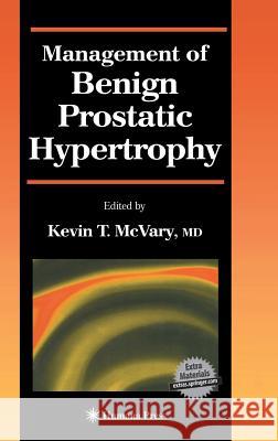 Management of Benign Prostatic Hypertrophy Kevin T. McVary 9781588291554 Humana Press