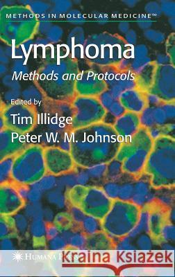 Lymphoma Timothy Illidge Tim Illidge Peter W. M. Johnson 9781588291592 Humana Press