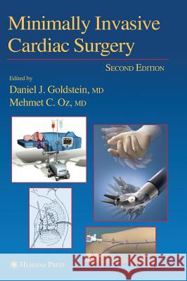 Minimally Invasive Cardiac Surgery Beverly Hashimoto Daniel J. Goldstein Mehmet C. Oz 9781588291707 Humana Press