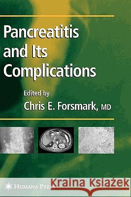 Pancreatitis and Its Complications Chris E. Forsmark Chris E. Forsmark Christopher E. Forsmark 9781588291790 Humana Press
