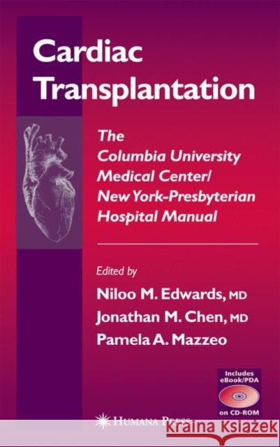 Cardiac Transplantation: The Columbia University Medical Center/New York-Presbyterian Hospital Manual Edwards, Niloo M. 9781588291813 Humana Press