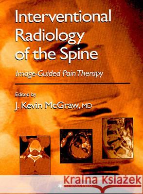 Interventional Radiology of the Spine: Image-Guided Pain Therapy McGraw, J. Kevin 9781588291981