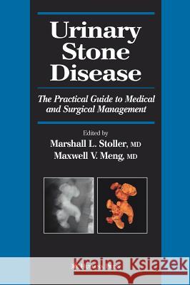 Urinary Stone Disease: The Practical Guide to Medical and Surgical Management Stoller, Marshall L. 9781588292193 Humana Press