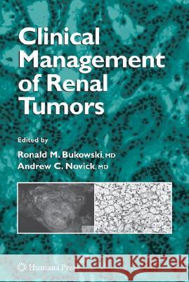 Clinical Management of Renal Tumors Ronald M. Bukowski Ronald M. Bukowski Andrew C. Novick 9781588292513