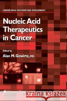 Nucleic Acid Therapeutics in Cancer Alan M. Gewirtz 9781588292582 Humana Press