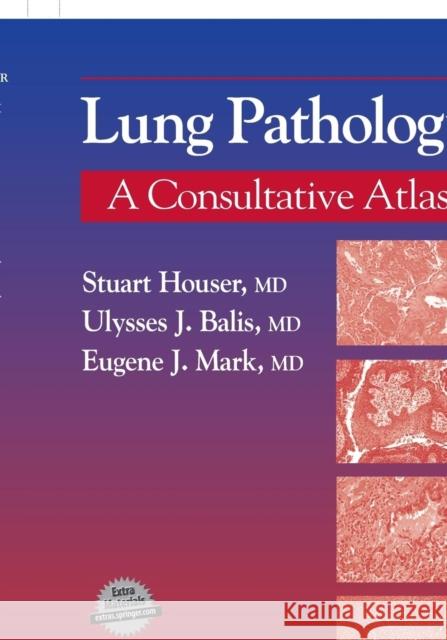 Lung Pathology Stuart Houser Eugene J. Mark Ulysses J. Balis 9781588293886 Humana Press