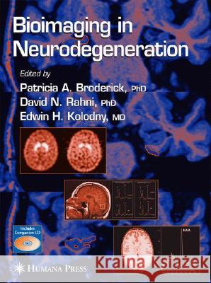Bioimaging in Neurodegeneration Patricia A. Broderick David N. Rahni Edwin H. Kolodny 9781588293916