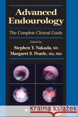 Advanced Endourology: The Complete Clinical Guide [With DVD] Nakada, Stephen Y. 9781588294463 Humana Press
