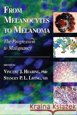 From Melanocytes to Melanoma: The Progression to Malignancy Vincent J. Hearing Stanley P. L. Leong 9781588294593 Humana Press