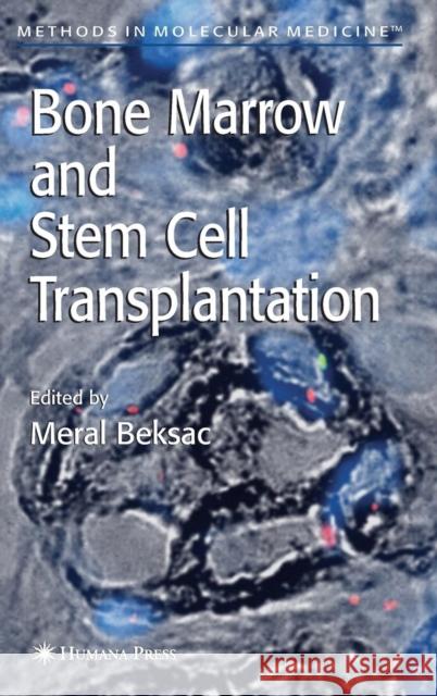 Bone Marrow and Stem Cell Transplantation Meral Beksac 9781588295958 Humana Press