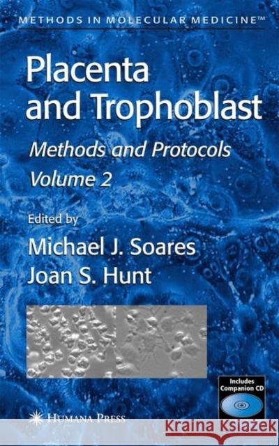 Placenta and Trophoblast: Methods and Protocols, Volume II Soares, Michael J. 9781588296085 Humana Press
