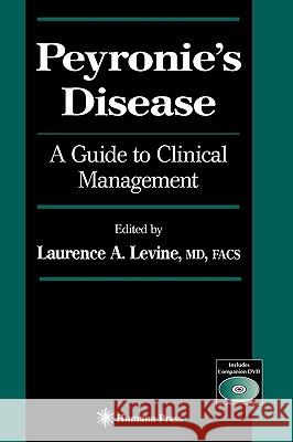 Peyronie's Disease: A Guide to Clinical Management Levine, Laurence A. 9781588296146 Humana Press