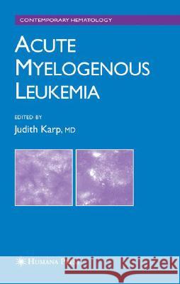 Acute Myelogenous Leukemia Judith E. Karp 9781588296214 Humana Press