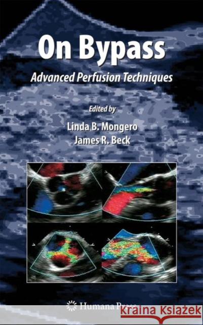 On Bypass: Advanced Perfusion Techniques Mongero, Linda B. 9781588296368 HUMANA PRESS INC.,U.S.