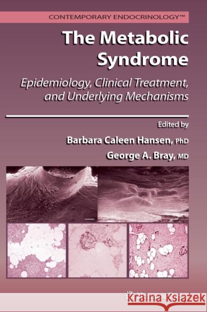 The Metabolic Syndrome: Epidemiology, Clinical Treatment, and Underlying Mechanisms Hansen, Barbara C. 9781588297389 Humana Press