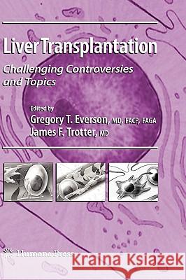 Liver Transplantation: Challenging Controversies and Topics Everson, Gregory T. 9781588297938