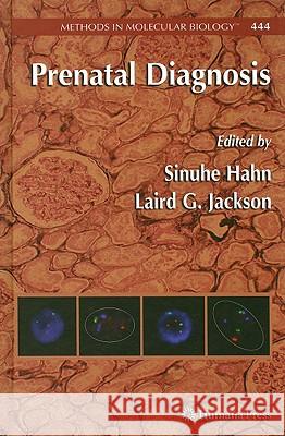 Prenatal Diagnosis Laird G. Jackson 9781588298034 Humana Press