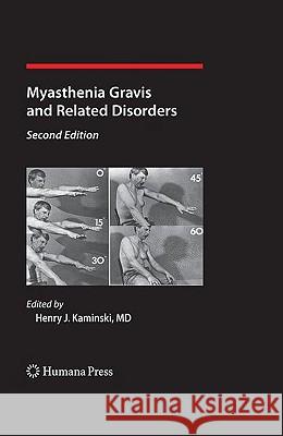 Myasthenia Gravis and Related Disorders Henry J. Kaminski 9781588298522 Humana Press