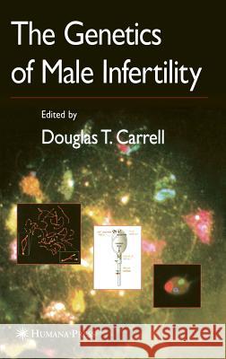 The Genetics of Male Infertility Douglas T. Carrell 9781588298638 Humana Press