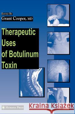 Therapeutic Uses of Botulinum Toxin Grant Cooper 9781588299147 Humana Press