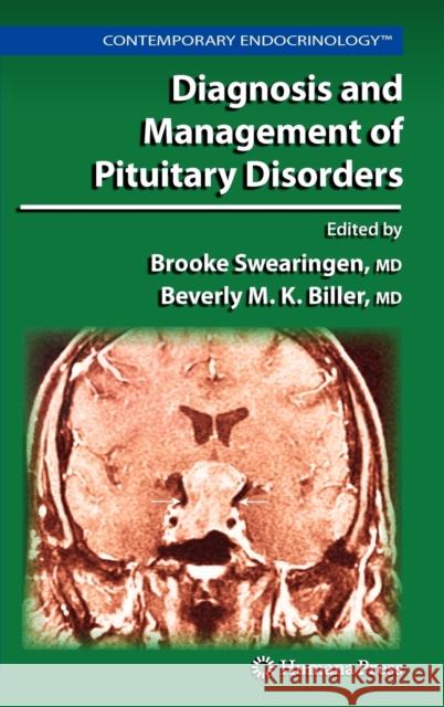 Diagnosis and Management of Pituitary Disorders  9781588299222 HUMANA PRESS INC.,U.S.