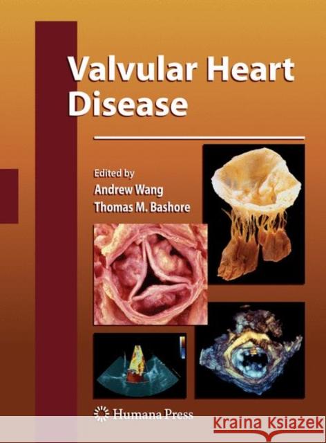 Valvular Heart Disease Andrew Wang Thomas Bashore 9781588299826 Humana Press