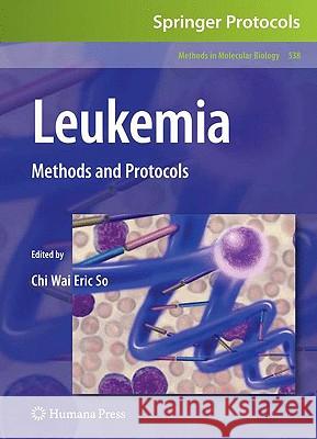 Leukemia: Methods and Protocols So, Chi Wai Eric 9781588299895 Humana Press
