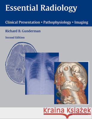 Essential Radiology: Clinical Presentation Pathophysiology Imaging Richard B. Gunderman 9781588900821 Thieme Medical Publishers