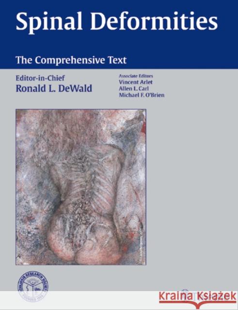Spinal Deformities: The Comprehensive Text Dewald, Christopher 9781588900890 Thieme Medical Publishers