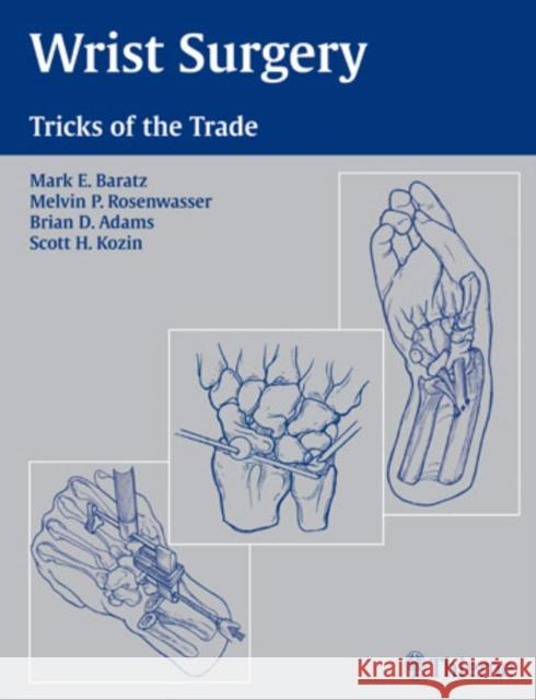 Wrist Surgery: Tricks of the Trade Baratz, Mark E. 9781588902177