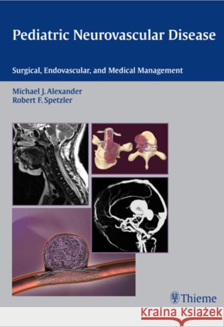 Pediatric Neurovascular Disease : Surgical, Endovascular and Medical Management Michael Alexander Robert F. Spetzler 9781588903686