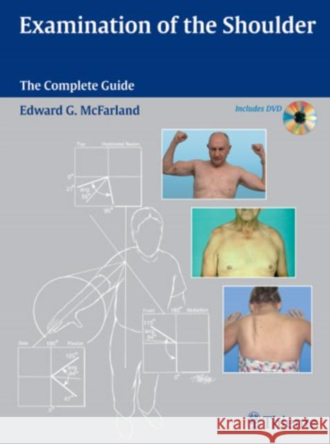 Examination of the Shoulder: The Complete Guide [With DVD] McFarland, Edward G. 9781588903716 Thieme Medical Publishers