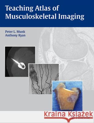 Teaching Atlas of Musculoskeletal Imaging Peter L. Munk 9781588903723