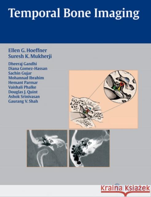 Temporal Bone Imaging S. K. Mukherji Ellen G. Hoeffner Suresh Mukherji 9781588904010 Thieme Medical Publishers