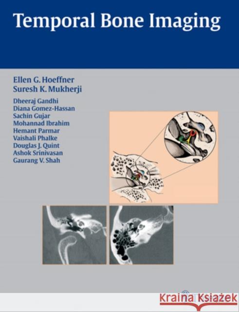 Temporal Bone Imaging S. K. Mukherji Ellen G. Hoeffner Suresh Mukherji 9781588904010