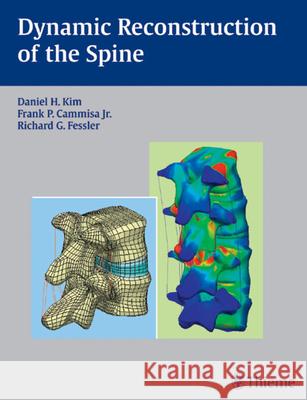 Dynamic Reconstruction of the Spine: Daniel H. Kim Frank P., Jr. Cammisa Richard G. Fessler 9781588904843 Thieme Medical Publishers