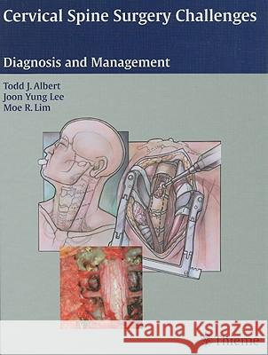 Cervical Spine Surgery Challenges : Diagnosis and Management T. J. Albert Todd Albert Joon Lee 9781588904942