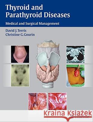 Thyroid and Parathyroid Diseases David J. Terris 9781588905185